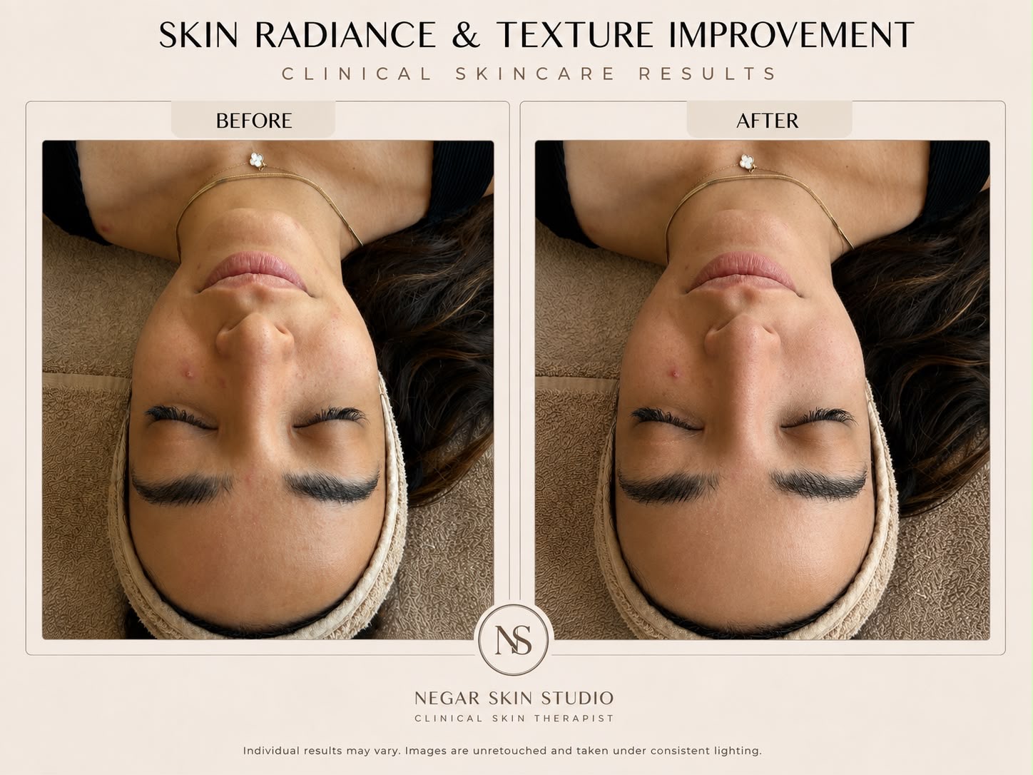 Skin radiance and texture improvement before and after result