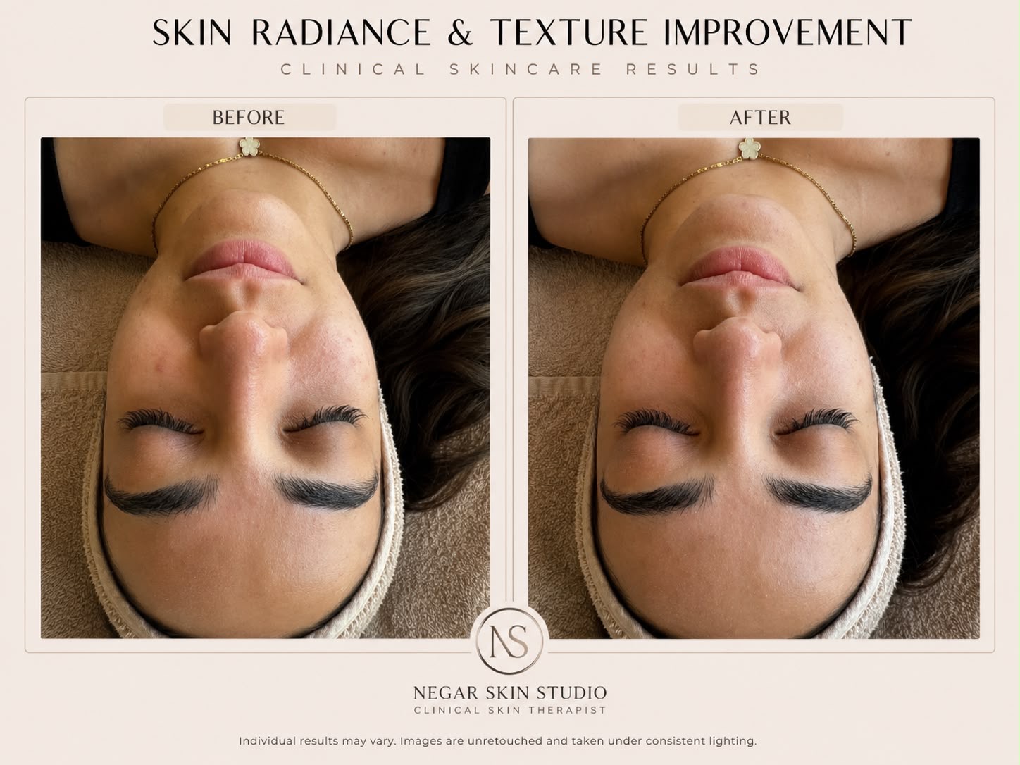 Skin radiance and texture improvement before and after result