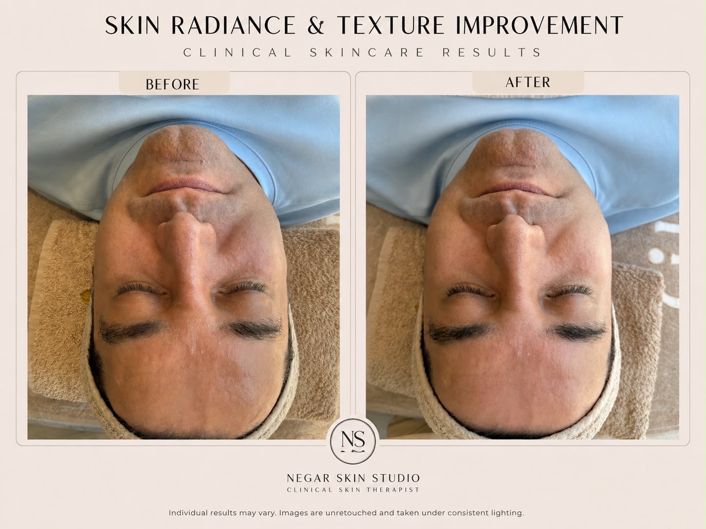 Clinical skincare before and after result